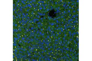 IF analysis of GSTA1/A2/A3/A4/A5 using anti-GSTA1/A2/A3/A4/A5 antibody (ABIN3043839) GSTA1/A2/A3/A4/A5 was detected in paraffin-embedded section of mouse liver tissues.