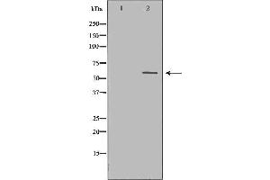 Western blot analysis of extracts of Jurkat using CASP10 Antibody. (Caspase 10 Antikörper)