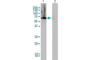 Western Blot analysis of AHCYL1 expression in transfected 293T cell line by AHCYL1 monoclonal antibody (M05), clone 5D6. (AHCYL1 Antikörper  (AA 1-101))