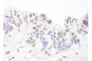 Immunohistochemistry (IHC) image for anti-Small Nuclear Ribonucleoprotein Polypeptide A (SNRPA) (AA 205-255) antibody (ABIN7453449)
