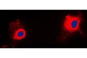 Immunofluorescent analysis of PIG11 staining in HuvEc cells. (TP53I11 Antikörper  (Center))