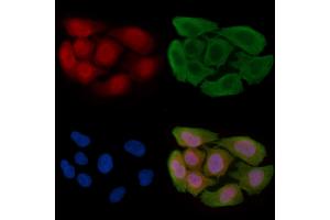 ABIN6256291 and ABIN6267489 staining Hela cells(30 min of UV treatment) by IF/ICC. (Aryl Hydrocarbon Receptor Antikörper  (pSer36))