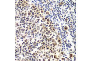 Immunohistochemistry of paraffin-embedded human amygdalitis using MSH6 antibody. (MSH6 Antikörper)