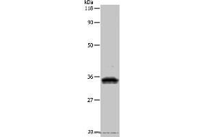 Western blot analysis of 293T cell, using UPK3B Polyclonal Antibody at dilution of 1:1000 (Uroplakin 3B Antikörper)