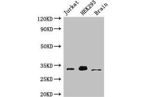 Western Blot Positive WB detected in: Jurkat whole cell lysate, HEK293 whole cell lysate, Mouse brain tissue All lanes: MBD3 antibody at 3 μg/mL Secondary Goat polyclonal to rabbit IgG at 1/50000 dilution Predicted band size: 33, 30 kDa Observed band size: 33 kDa (MBD3 Antikörper  (AA 79-209))