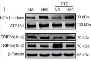 anti-Peroxisomal Biogenesis Factor 5-Like (PEX5L) (AA 1-192), (Constant Region) antibody