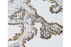 Immunohistochemistry of paraffin-embedded Human prostate using IL25 Polyclonal Antibody at dilution of 1:100 (40x lens). (IL-25 Antikörper)