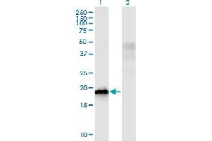 Western Blot analysis of CIRBP expression in transfected 293T cell line by CIRBP monoclonal antibody (M03), clone 1C9. (CIRBP Antikörper  (AA 1-90))