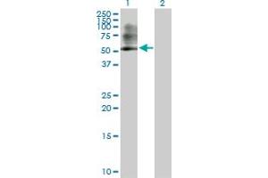 Western Blot analysis of PSMC3 expression in transfected 293T cell line by PSMC3 MaxPab polyclonal antibody. (PSMC3 Antikörper  (AA 1-439))