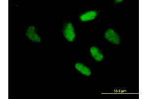 Immunofluorescence of purified MaxPab antibody to RFX3 on HeLa cell. (RFX3 Antikörper  (AA 1-749))