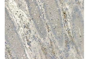 ABIN6256669 and ABIN6267133 at 1/100 staining human normal colon tissue by IHC-P. (LAT Antikörper  (pTyr200))