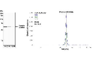 Western Blotting (WB) image for anti-Branched Chain Keto Acid Dehydrogenase E1, alpha Polypeptide (BCKDHA) (pSer292) antibody (ABIN7795621)