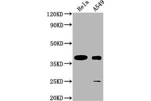 Western Blot Positive WB detected in: Hela whole cell lysate, A549 whole cell lysate All lanes: TAS2R7 antibody at 1:2000 Secondary Goat polyclonal to rabbit IgG at 1/50000 dilution Predicted band size: 37 kDa Observed band size: 37 kDa (TAS2R7 Antikörper  (AA 151-168))