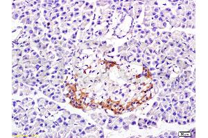 Formalin-fixed and paraffin embedded: rat pancreas tissue labeled with Anti-PP-1B Polyclonal Antibody (ABIN725465), Unconjugated at 1:300 followed by conjugation to the secondary antibody and DAB staining (PPP1CB Antikörper  (AA 155-250))