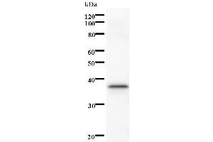 Western Blotting (WB) image for anti-serine/threonine Kinase 3 (STK3) antibody (ABIN933165) (STK3 Antikörper)