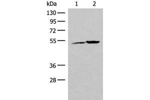Western blot analysis of K562 cell and Human heart tissue lysates using FECH Polyclonal Antibody at dilution of 1:500 (FECH Antikörper)