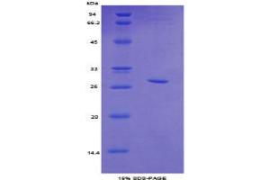 SDS-PAGE analysis of Mouse Topoisomerase II beta Protein. (TOP2B Protein)