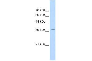 WB Suggested Anti-RALY Antibody Titration:  1. (Raly Antikörper  (C-Term))