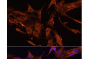Immunofluorescence analysis of C6 cells using RECK Polyclonal Antibody at dilution of 1:100 (40x lens). (RECK Antikörper)
