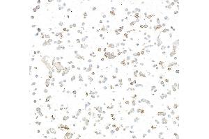 Immunocytochemistry (ICC) image for anti-Oxidized Low Density Lipoprotein (Lectin-Like) Receptor 1 (OLR1) (AA 61-273) antibody (ABIN7795657) (Rekombinanter OLR1 Antikörper  (AA 61-273))