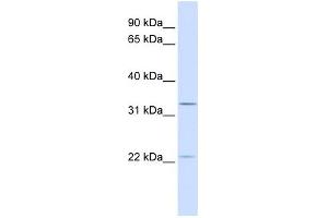 BRI3BP antibody used at 1 ug/ml to detect target protein. (BRI3BP Antikörper  (C-Term))