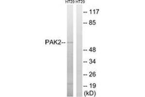 Western blot analysis of extracts from HT-29 cells, using PAK2 (Ab-197) Antibody. (PAK2 Antikörper  (AA 163-212))