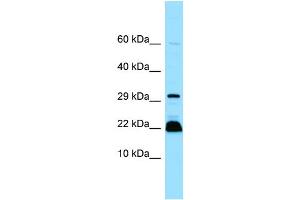 Western Blotting (WB) image for anti-Myosin Light Chain, phosphorylatable, Fast Skeletal Muscle (MYLPF) (C-Term) antibody (ABIN2774445)