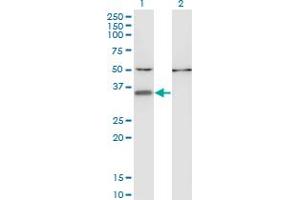Western Blot analysis of CENPV expression in transfected 293T cell line by CENPV monoclonal antibody (M05), clone 1D9. (CENPV Antikörper  (AA 173-272))