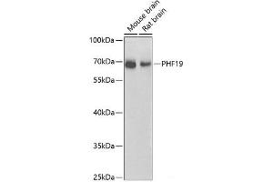 Western blot analysis of extracts of various cell lines using PHF19 Polyclonal Antibody at dilution of 1:1000. (PHF19 Antikörper)