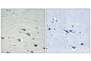 Immunohistochemistry (IHC) image for anti-Neurotrophic Tyrosine Kinase, Receptor, Type 1 (NTRK1) (pTyr757) antibody (ABIN1847659) (TRKA Antikörper  (pTyr757))
