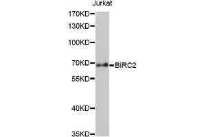 Western blot analysis of extracts of Jurkat cells, using BIRC2 antibody (ABIN5970373) at 1/1000 dilution. (BIRC2 Antikörper)