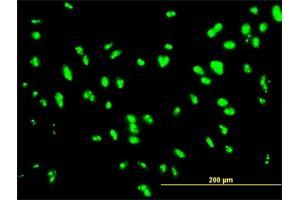 Immunofluorescence of monoclonal antibody to UBTF on HepG2 cell. (UBTF Antikörper  (AA 551-650))