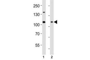 Western blot analysis of lysate from (1) HeLa cell line and (2) human skeletal muscle tissue using Dnmt3a antibody at 1:1000. (DNMT3A Antikörper  (AA 463-497))
