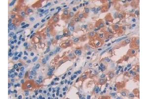 Immunohistochemistry (IHC) image for anti-Interleukin 15 (IL15) (AA 50-162) antibody (ABIN7430678)