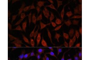 Immunofluorescence analysis of L929 cells using NEDD4L Polyclonal Antibody at dilution of 1:100. (NEDD4-2 Antikörper)