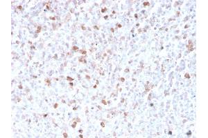 Formalin-fixed, paraffin-embedded human spleen stained with Lambda Light Chain Recombinant Rabbit Monoclonal Antibody (LLC/3778R). (Rekombinanter IgL Antikörper)