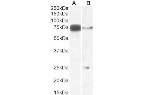 DLL1 Antikörper  (Internal Region)