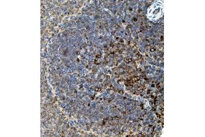 IHC analysis of CD74 using anti-CD74 antibody (ABIN7603166). (CD74 Antikörper  (N-Term))
