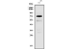 Western blot analysis of FUT4 using anti-FUT4 antibody (ABIN7602822).