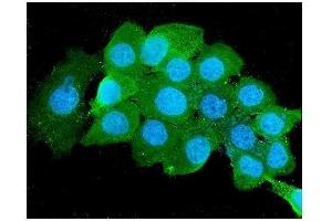 IF analysis of Beta 2 Microglobulin using anti-Beta 2 Microglobulin antibody (ABIN6719452). (beta-2 Microglobulin Antikörper  (AA 22-119))
