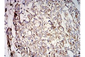Immunohistochemistry (IHC) image for anti-Superoxide Dismutase 2, Mitochondrial (SOD2) (AA 1-222) antibody (ABIN5542468)