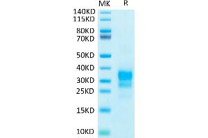 Biotinylated Human IFN-gamma on Tris-Bis PAGE under reduced condition. (Interferon gamma Protein (IFNG) (His-Avi Tag,Biotin))