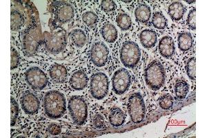 Immunohistochemistry (IHC) analysis of paraffin-embedded Human Colon, antibody was diluted at 1:100. (AAT (Internal Region) Antikörper)