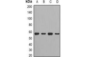 Western blot analysis of CCT2 expression in A549 (A), HT29 (B), mouse spleen (C), mouse heart (D) whole cell lysates. (CCT2 Antikörper)