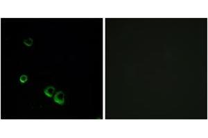 Immunofluorescence analysis of MCF7 cells, using AVPR2 Antibody. (AVPR2 Antikörper  (AA 72-121))