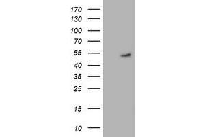 HEK293T cells were transfected with the pCMV6-ENTRY control (Left lane) or pCMV6-ENTRY GSS (Right lane) cDNA for 48 hrs and lysed. (Glutathione Synthetase Antikörper)