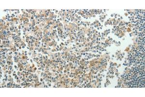 Immunohistochemistry of paraffin-embedded Human tonsil using NDRG3 Polyclonal Antibody at dilution of 1:70 (NDRG3 Antikörper)