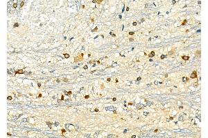 ABIN6263048 and ABIN6276825 at 1/100 staining Rat brain tissue by IHC-P. (MAD2L1 Antikörper  (Internal Region))