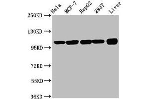Western Blot Positive WB detected in: Hela whole cell lysate, MCF-7 whole cell lysate, HepG2 whole cell lysate, 293T whole cell lysate, Rat liver tissue All lanes: ACTN4 antibody at 3. (alpha Actinin 4 Antikörper  (AA 160-440))