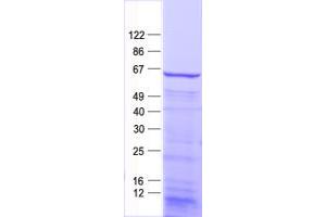 Validation with Western Blot (Myotilin Protein (MYOT) (His tag))